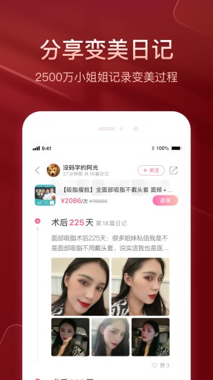 悦美app破解版